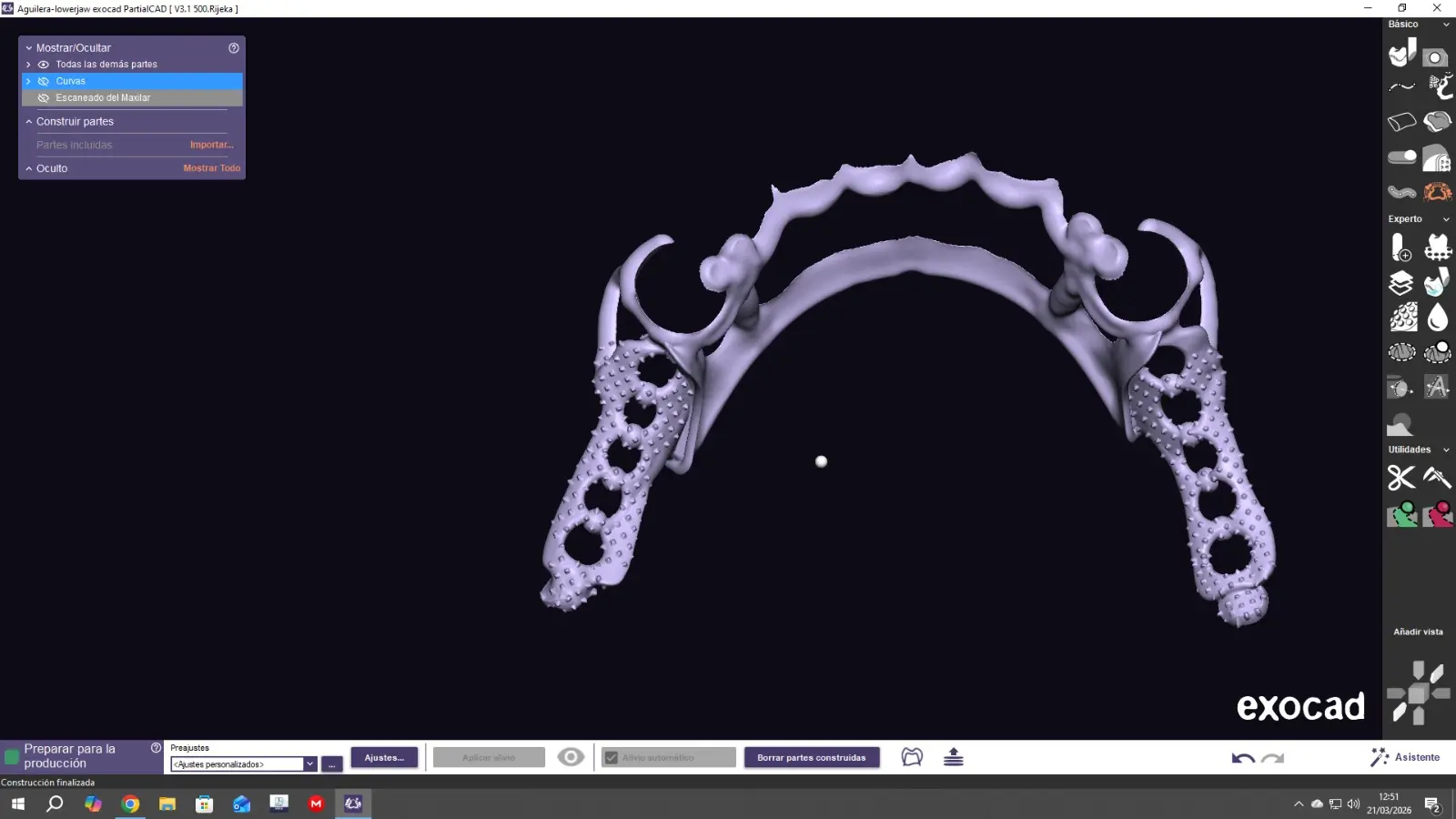 Diseño digital de estructura metálica inferior en Exocad con ganchos y conectores