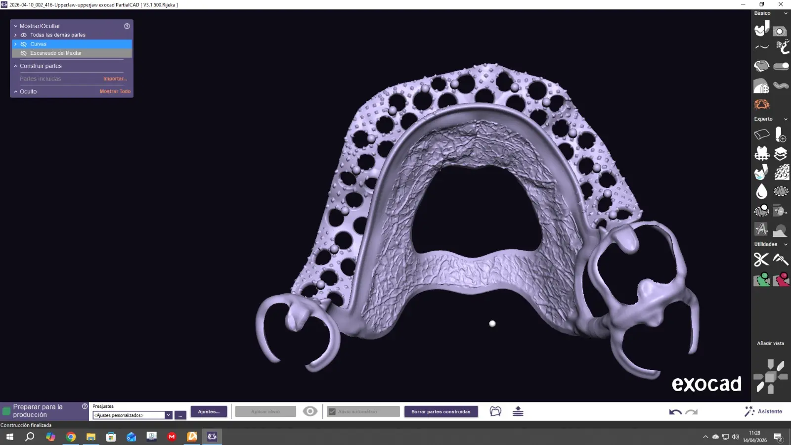 Diseño CAD de estructura metálica superior en Exocad con placa palatina y ganchos