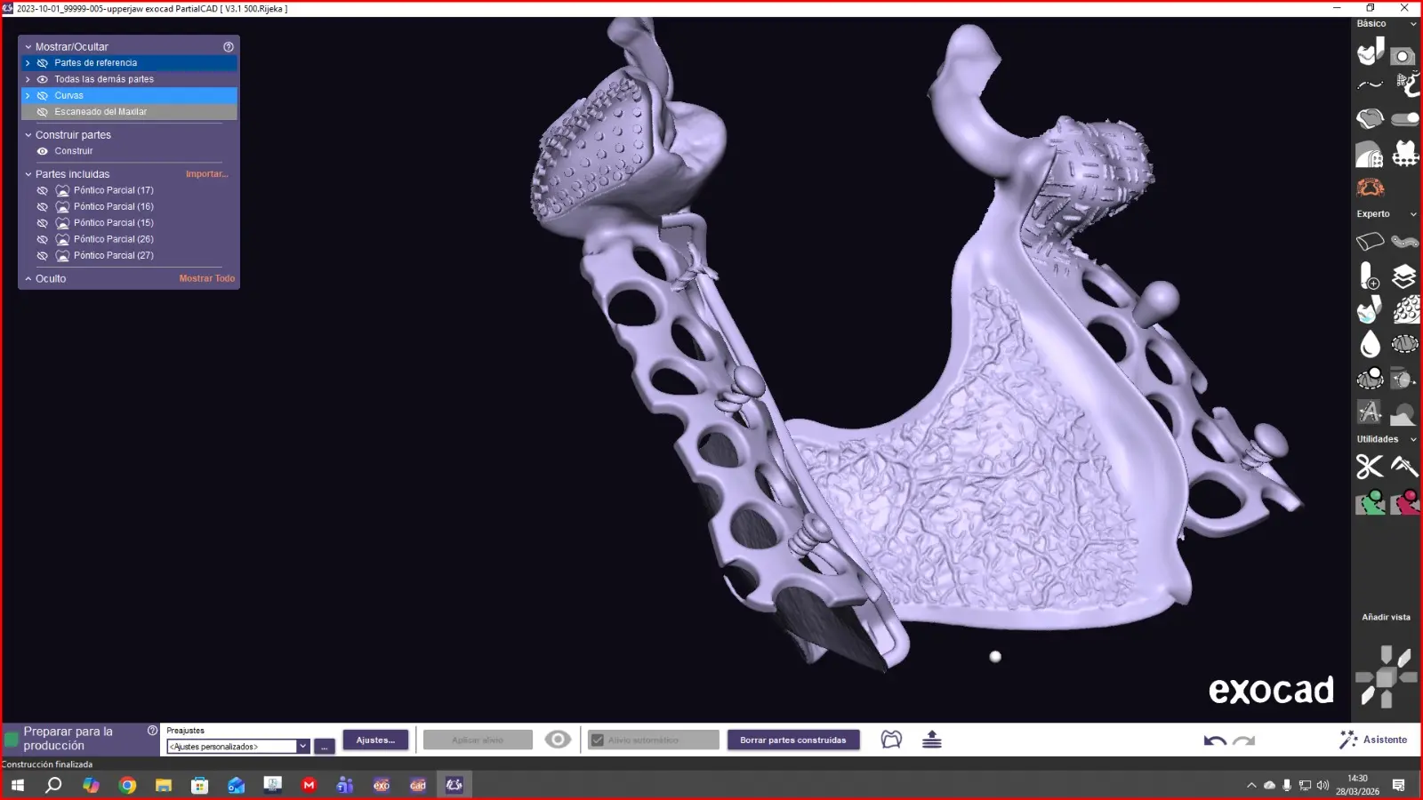 Diseño CAD de PPR con ponticos metálicos en Exocad PartialCAD
