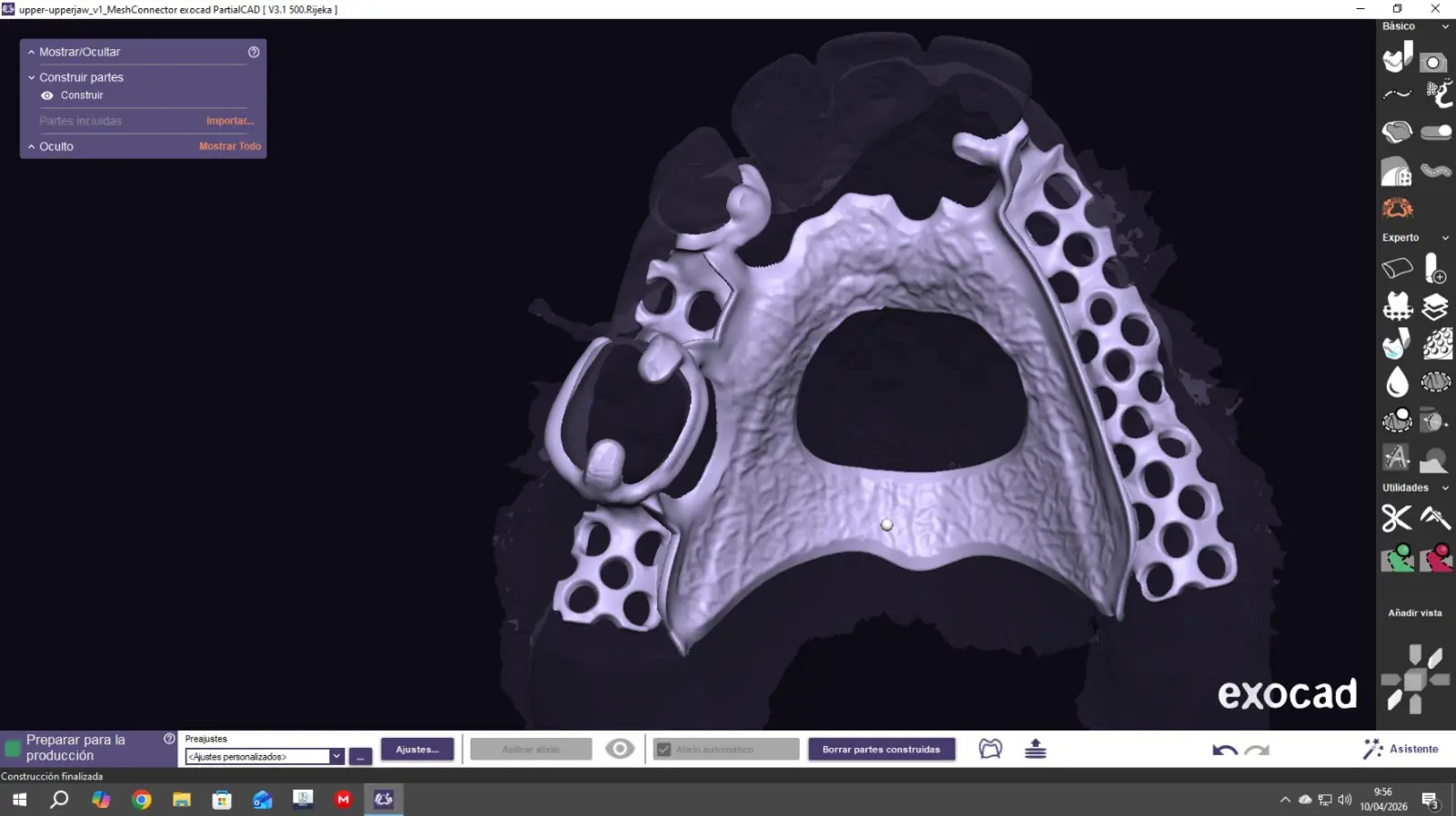 Diseño digital en Exocad a partir de modelo escaneado en 3D con vista oclusal