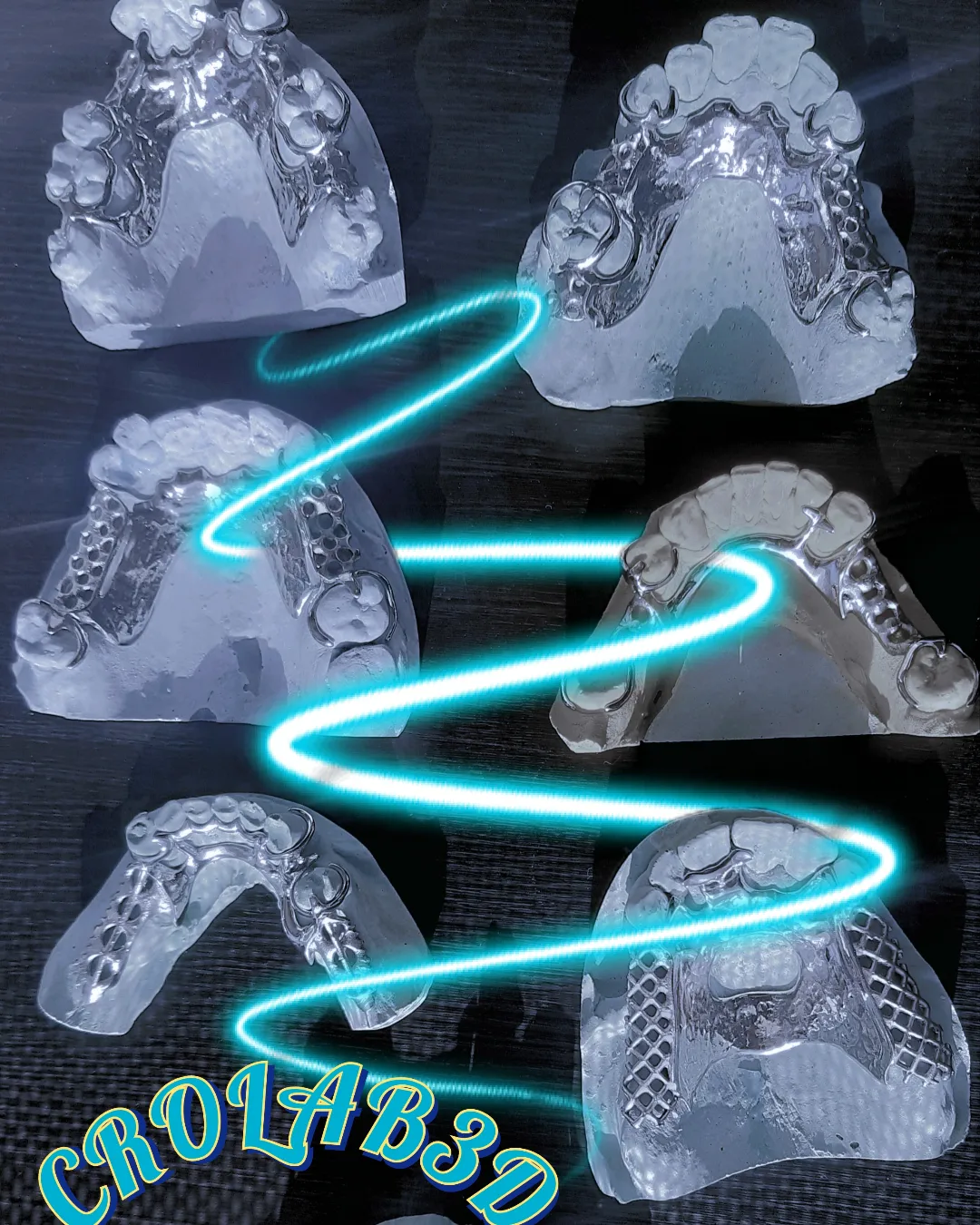 Modelos impresos en 3D para Invisalign