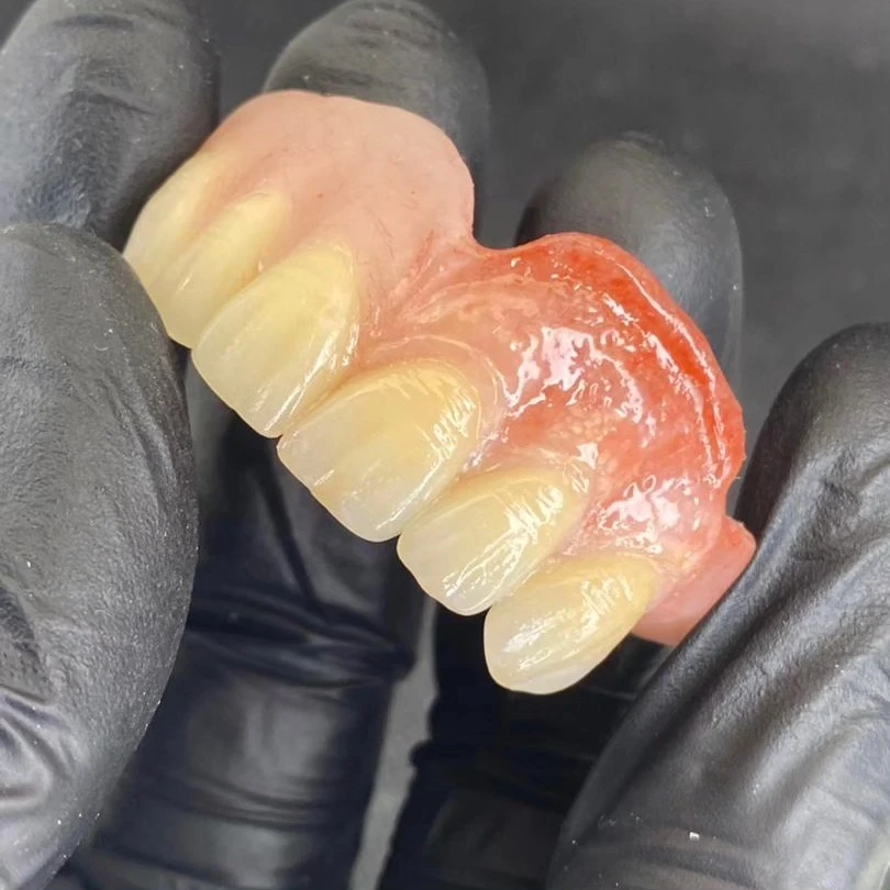 Prótesis flexible dental sin metal