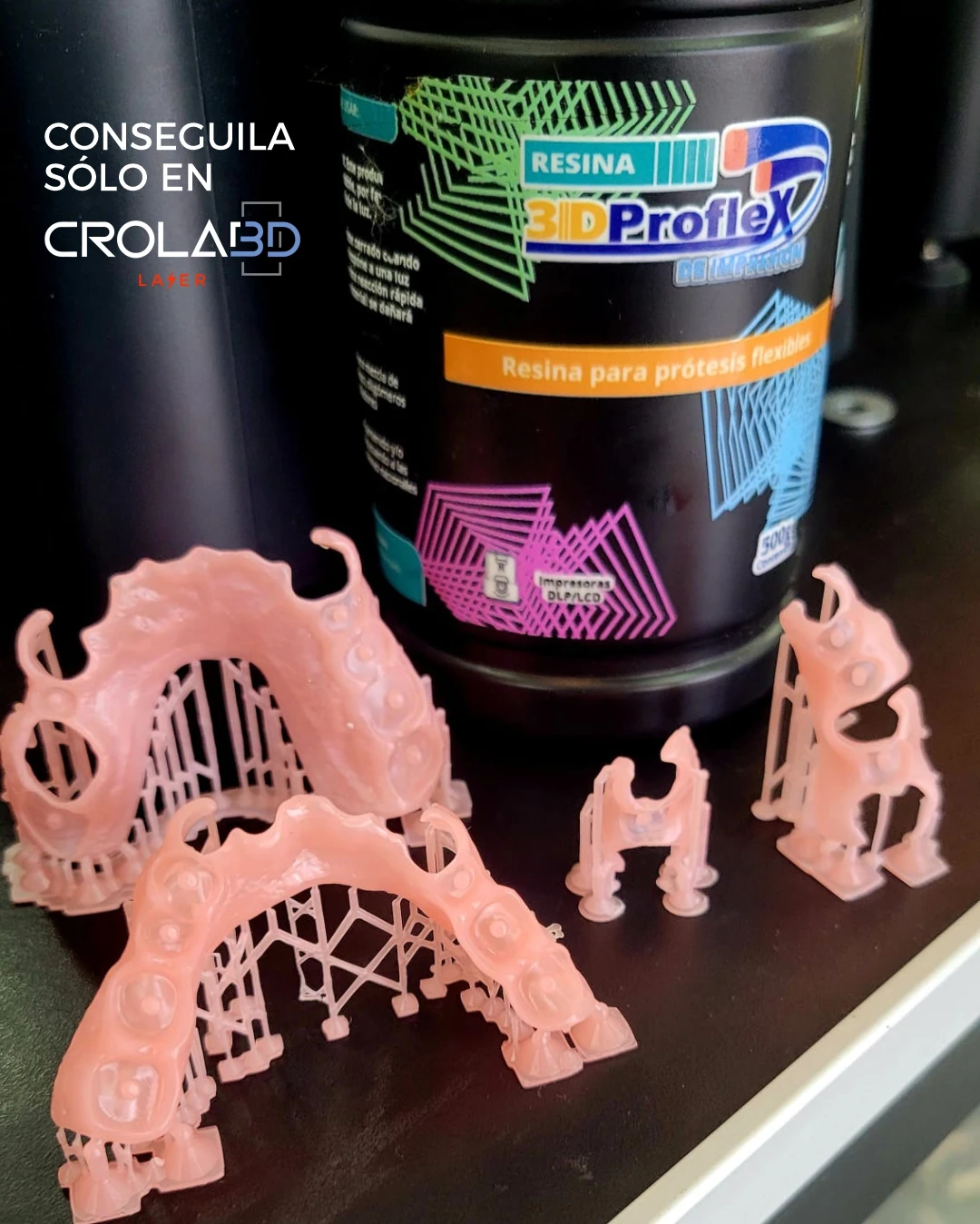 Prótesis parcial flexible dental con ganchos en resina sin metal
